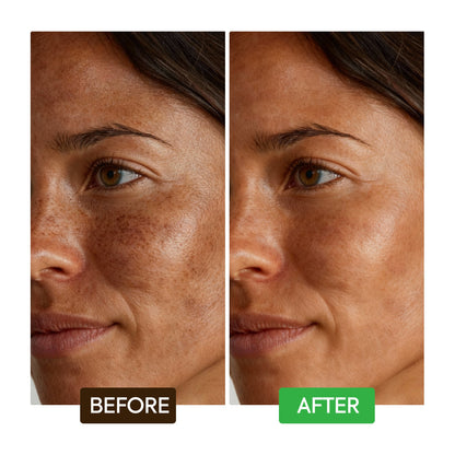 Kojic Acid Dark Spot Remover Soap Bars - Image 5