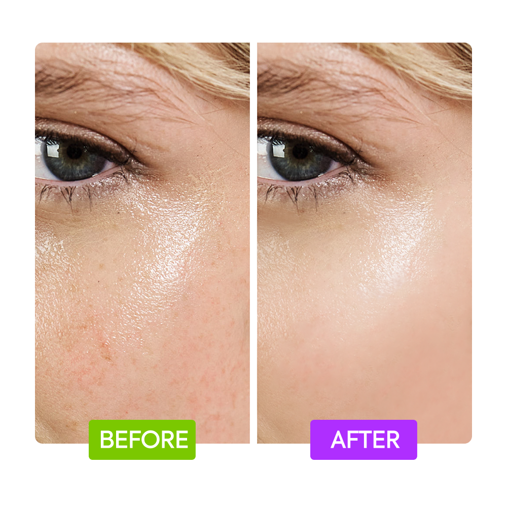 20% Aha + 10% Niacinamide Booster - IYKYK - Image 6