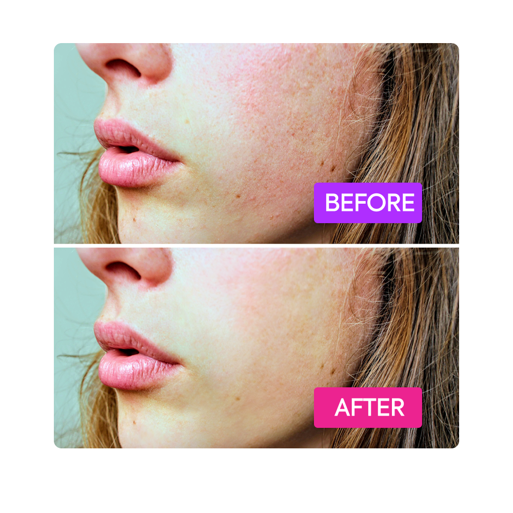 Probiotics Booster - IYKYK - Image 6