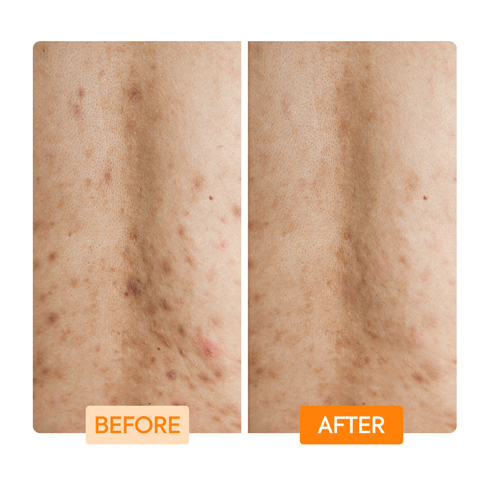 Glycolic + Lactic Acid + Niacinamide Body Wash - IYKYK - Image 6