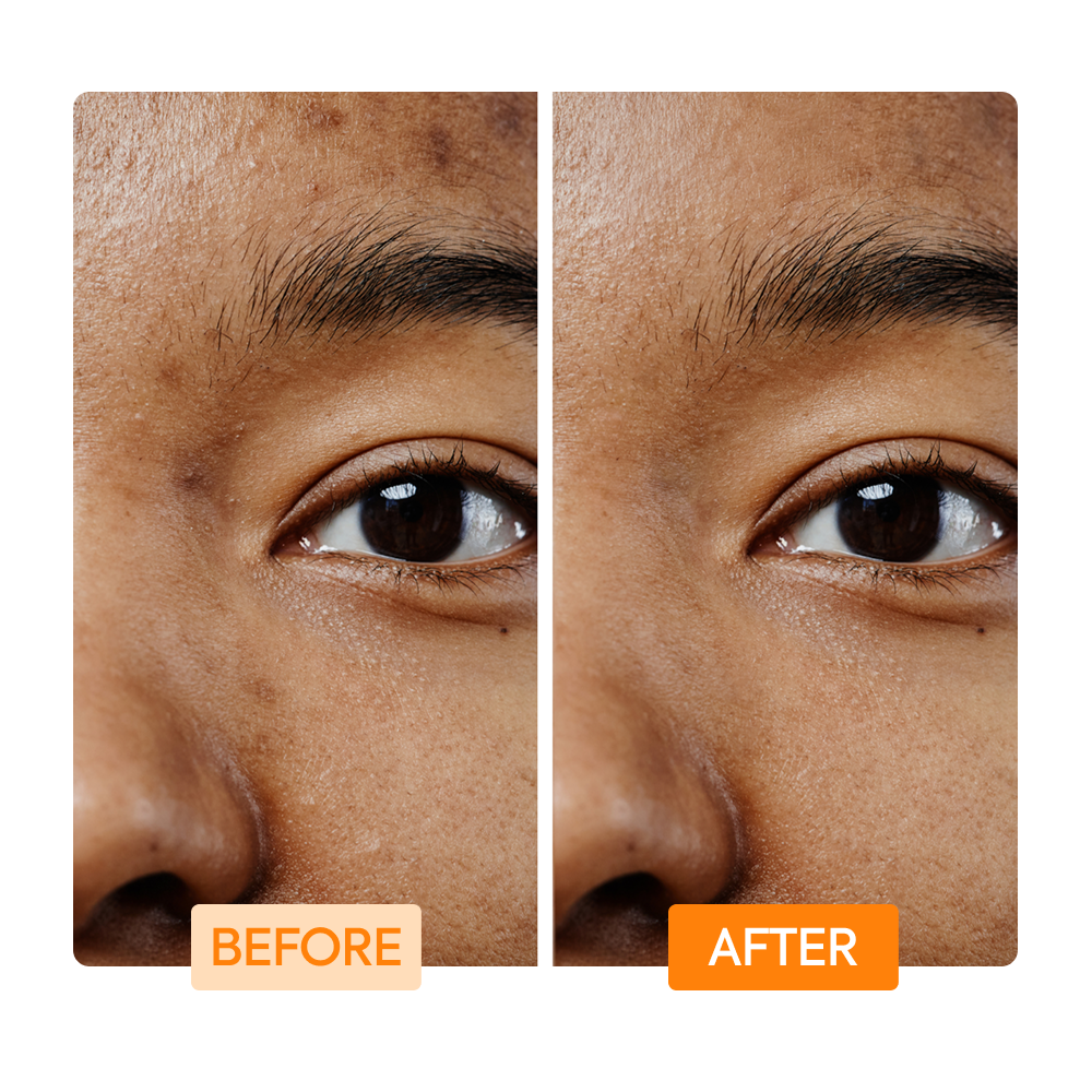 Vitamin C & Turmeric Facial Cleansing Bar - IYKYK - Image 6