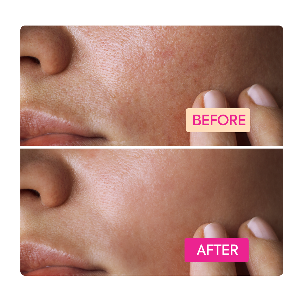 Niacinamide Facial Cleansing Bar - IYKYK - Image 6